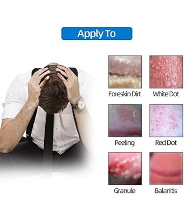 Gimtella Balanitis Relief Ointment - All-Natural Soothing Skin Relief for Irritation, Itch, Redness, and Inflammation - Buy Online on GoSupps.com