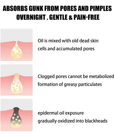 10pcs Hydrocolloid Blackhead Removal Patches | Deep Cleansing Pore Strips for Face, Nose, and Pores | Dermatologist Approved | Overnight Use - Buy Online on GoSupps.com