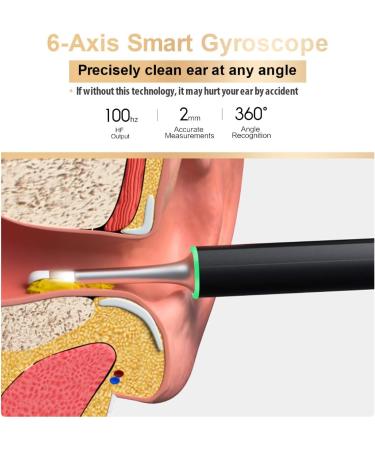 BEBIRD X17 Pro Ear Wax Removal Camera Endoscope - WiFi, Gyroscope, 1080p Visual Ear Cleaner for Kid, Adult, Pet - Buy Online on GoSupps.com