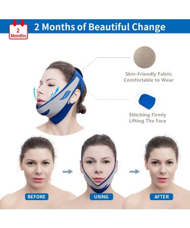 BIUBIU TOWNLET Double Chin Reducer Face Slim Strap - Reusable Anti-Wrinkle Face-Lifting Artifact for Firmer Skin (Normal-Plus) - Buy Online on GoSupps.com