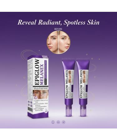zowamap Ceoerty EPIGLOW MelanEX Advanced AntiHyperpigmentation Cream Targets Stubborn Dark Spots Dark Spot Corrector for Face for All Skin Types 2PCS - Buy Online on GoSupps.com