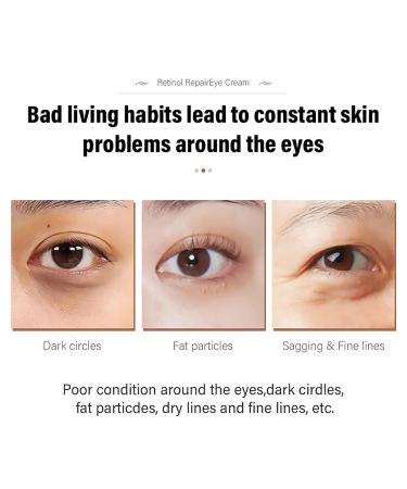 2 Pcs Retinol Repair Eye Cream Instant Results Eye Cream Reduces the Appearance of Dark Circles Stretch Wrinkles at the Corners of the Eyes Moisturize and Improve Eye Bags 1.05 Oz Each - Buy Online on GoSupps.com