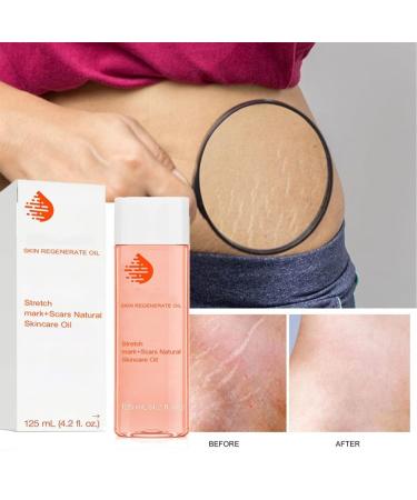 Optimal Oil Collagen Boost Firming & Lifting Skincare Oil - All Skin Types (1PC) - Buy Online on GoSupps.com