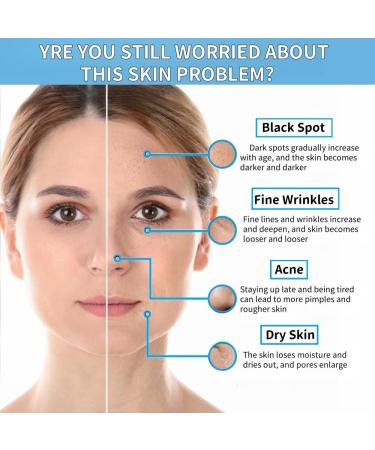 Niacinamide 10% + Zinc 1% Serum for Face Oil Control Acne Pore Minimizer & Blemish Reduction Lightweight Non-Greasy Facial Serum 30ml (1 Fl Oz) (1) - Buy Online on GoSupps.com