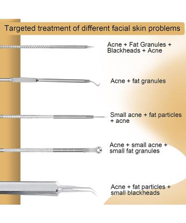 Stainless Steel Blackhead Remover Tool Kit - 5PCS Set for Face, Comedone Extraction Tools - Buy Online on GoSupps.com