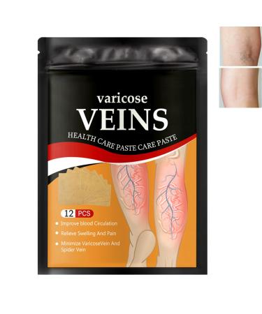 Varicose vein pavement for legs spider vein distance varicose veins relief patch vein patches against spider veins varicose veins & spider veer-extract treatment plaster vein relief herbal plasters
