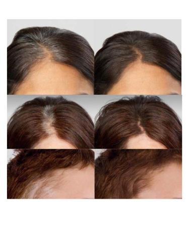 Root Touch Up Grey Hair Concealer | Light Brown Root Cover Up for Quick and Easy Grey Hair Solutions - Buy Online on GoSupps.com