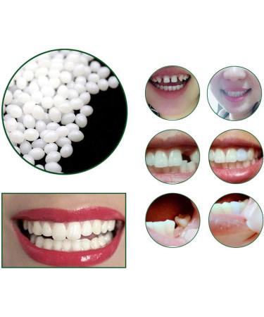 Tooth Repair Kit - Instant Temporary Teeth Replacement for Damaged & Missing Teeth | Best Dental Fix Solution - Buy Online on GoSupps.com