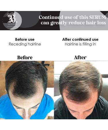 Biotin Hair Growth Treatment & Thermal Protectant Serum - High Potency Anti Hair Loss Styling Serum for Dry & Damaged Hair - UV Protectant - 4oz - Buy Online on GoSupps.com