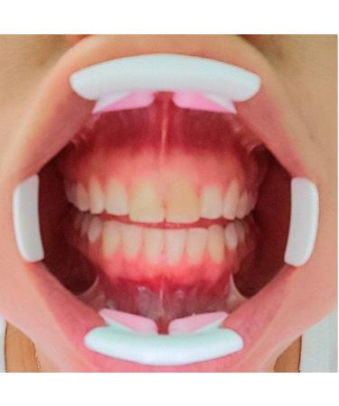 Wudaizhi Mouth Opener - 2pcs 3D Teeth Whitening Accessory | Reusable Cheek Opener for Optimal Oral Care - Buy Online on GoSupps.com