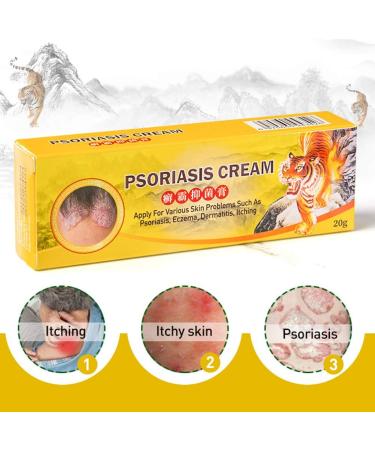 Worglo Ultimate Psoriasis Relief Cream - Soothes Irritated Itching, Controls Reoccurrences, and Comforts Scaling Skin - Buy Online on GoSupps.com