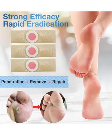 MQ 36 Pcs Corn Removal Pads for Foot Corn, Toe Corn, Callus Removal - Stops Wart Regrowth & Provides Pain Relief - Foot Care (36 Count) - Buy Online on GoSupps.com