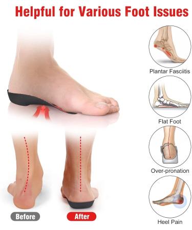 Orthotic Insoles 3/4 High Arch Support Shoe Inserts - Large Size (9-12 UK) for Plantar Fasciitis and Heel Pain - Buy Online on GoSupps.com