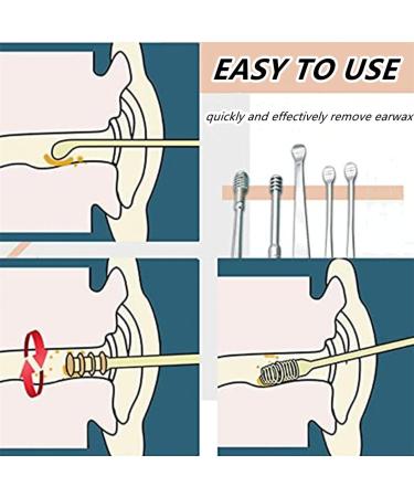 2023 Professional Stainless Steel Ear Wax Removal Kit - 6pc Spring Earwax Cleaner Tool Set (Blue) - Buy Online on GoSupps.com