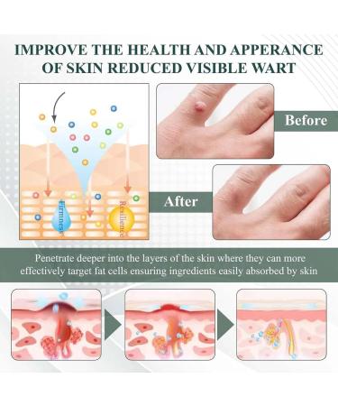 Skin Clear Herbal Jelly Gel Dark Spot Remover Cream for Face and Body Gel rafra chissant base de plantes gel pour l' limination des taches sombres du visage et du corps Soin Visage Enrichi - Buy Online on GoSupps.com