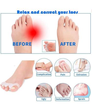Yoga Gel Toe Separators - Foot Pain Relief & Toe Straightener Spreader - Silicone Toe Spacers for Bunions & Hammer Toe - 2 Pairs White - Buy Online on GoSupps.com