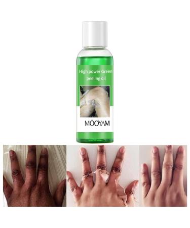 Peeling Oil for Dark Skin Green Peeling Oil Facial Peeling Oil with Hyaluronate Exfoliating Peeling Solution for Body Chemical Peel At Home for Dark Spots Body Peeling for All Skin Type 3.66 OZ