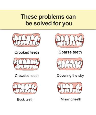 Instant Fake Teeth Dental Veneers for Temporary Tooth Restoration - Upper Jaw Veneers Dentures Socket | Denture Repair Kits - Fix Your Smile At Home! - Buy Online on GoSupps.com