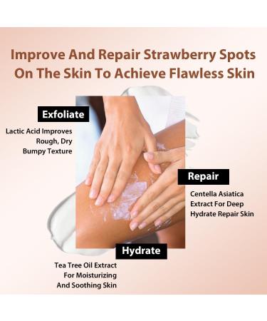 Strawberry Legs Treatment Cream For Women Keratosis Pilaris Lotion Chicken Skin Treatment Moisturizing Strawberry Skin Smooth Radiant Skin Care Solution Exfoliating Body Cream 120G - Buy Online on GoSupps.com