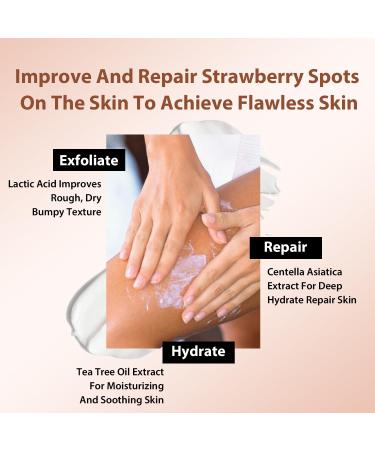 Strawberry Legs Treatment Cream | Exfoliating Lotion for Keratosis Pilaris & Dry Skin | Radiant & Smooth Skin Solution - Buy Online on GoSupps.com