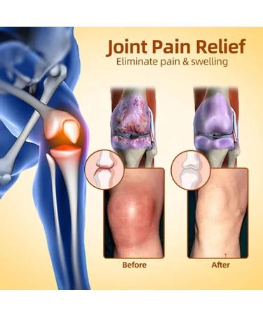 3PCS Bostore Canadian Bee Venom Alleviating Bone Pain Cvreoz Australian Honey Bee Cream New Zealand Bee Venom Joint Relief Cream Joint Relief Gel Pain Relief Cream - Buy Online on GoSupps.com