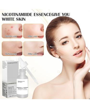 S rum la niacinamide - Essence hydratante pour le visage - 10 % niacinamide + 1 % de zinc - Convient pour tous les types de peau - 30 ml - Buy Online on GoSupps.com