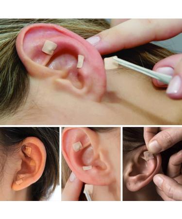600 Disposable Ear Seeds for Acupressure | Ear Seed Acupuncture & Massage Stickers 10 Sheets - Buy Online on GoSupps.com
