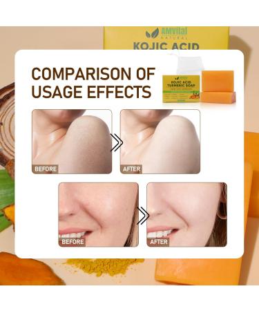 Turmeric Kojic Acid Soap Bars (2 Pack) - Brightening Soap with Vitamin C Retinol Collagen & Hyaluronic Acid for Dark Spots - Buy Online on GoSupps.com