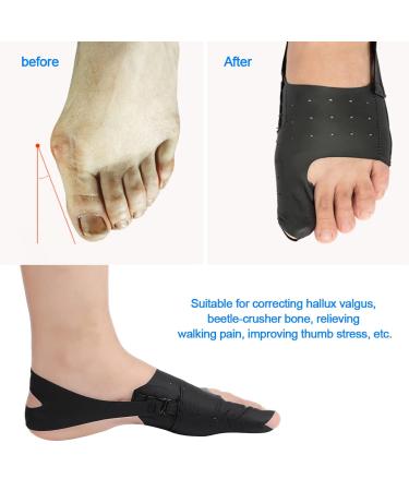 Toe Correction Bunion Adjuster - Ultrad nner Hallux Valgus Corrector & Orthopedic Braces for Bunion Relief - Buy Online on GoSupps.com