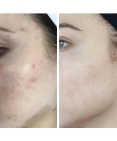 Buy HigherDOSE Light-Activated Glow Serum - Anti-Aging Vitamin C & Hyaluronic Acid Face Serum for Hydration & Fine Lines - Ships Internationally - Buy Online on GoSupps.com
