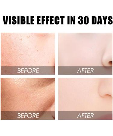 Rose Facial Oil Instant Face Firming & Plumping Rose Anti Aging Face Moisturizer Hyaluronic Acid Serum for Face Antioxidant Firming Night Serum for face Improve Dull Skin & Soft Skin Tone-30ml - Buy Online on GoSupps.com