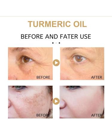 Turmeric Face Serum - Dark Spot Correcting Glow Serum with Turmeric Oil for Skin - Reduces Age Spots - Moisturzing Body & Face Oils and Serums. - Buy Online on GoSupps.com