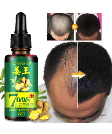 Advanced Hair Growth Serum - Accelerate Growth Thicken & Regrow Hair Anti-Hair Loss Treatment for Thin Hair - Buy Online on GoSupps.com