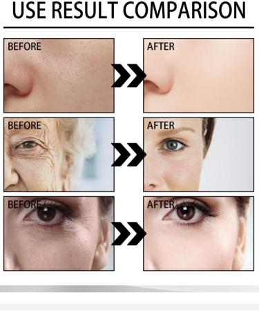 SNAIL MUCIN SERUM MOISTURIZER-96.3% Snail Mucin Serum Moisturizer-Korean Skin Care for Flawless Wrinkle Free Super Moisturized Firm Pore and Spot Free Radiant Facial Skin-1 pack (1) - Buy Online on GoSupps.com