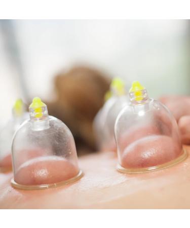 Buy Sifa 50x Cupping Glasses & Pump - Hijama Cupping Cups (6cm) for Holistic Health - International Shipping Available - Buy Online on GoSupps.com