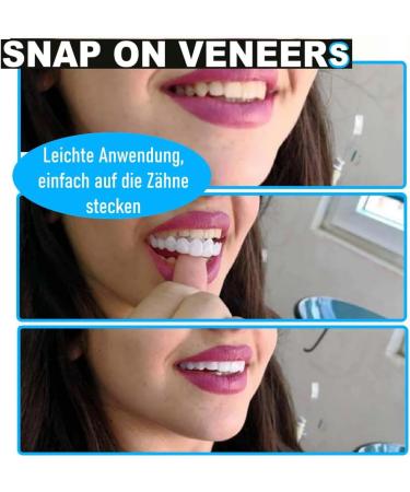 Snap-On Veneers | Comfortable Cosmetic Dental Prosthesis & Flex Dentures for a Perfect Smile - Buy Online on GoSupps.com