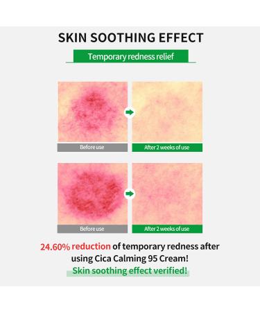 Wellage Cica Calming Cream 2.7oz | Soothing Face Moisturizer with Madecassoside for Sensitive Skin Anti-Redness & Anti-Scaling - Buy Internationally - Buy Online on GoSupps.com