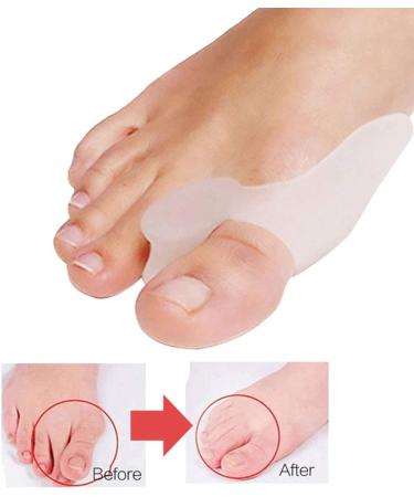 Pedimend Silicone Gel Toe Separator for Hallux Valgus Unisex Big Toe Protector & Straightening Holder | Effective Foot Care Solution - Buy Online on GoSupps.com