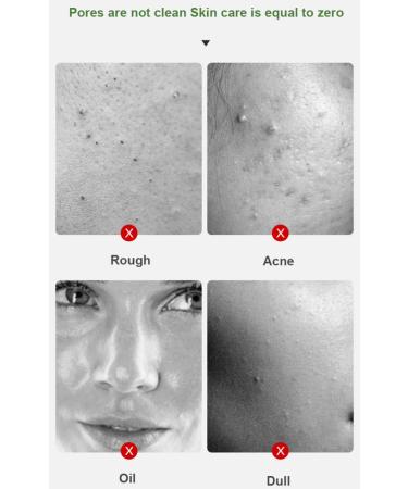 Green Tea Mask Stick - Blackhead Remover & Deep Pore Cleansing Clay | Moisturizing Oil Control & Anti-Acne Facial Care - Buy Online on GoSupps.com