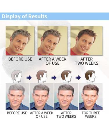 Restoria Discreet Colour Restoring Cream - 8.45 Fl.Oz. | Restore Hair Colour Naturally - Buy Online on GoSupps.com