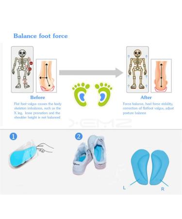 Kids Gel Orthotics Arch Support Pads for Flat Feet - O/X Type Leg Corrective Insoles Silicone Posture Corrector for Plantar Fasciitis Shock Absorbing Inserts for Children - International Shipping Available - Buy Online on GoSupps.com