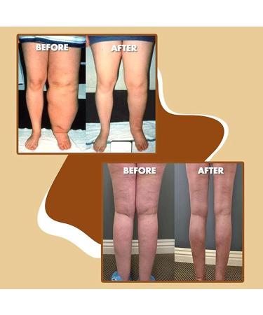 Natural Organic Ginger Essential Oil - Lymphatic Drainage & Spa Massage - 30ml (3PCs) | Relaxation & Wellness - Buy Online on GoSupps.com