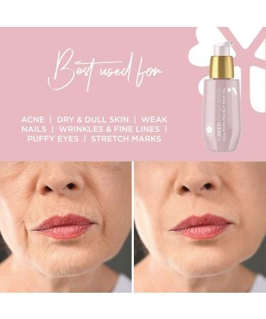 100% Organic Prickly Pear Seed Oil - Luxury Anti-Aging Moisturizer | 30ml for Elasticity Varicose Veins & Dark Circles - Buy Online on GoSupps.com