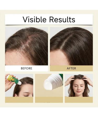  XINRAN Ginger essential oil roll-on for hair 7-day nourishing ginger scalp roll-on ginger growth oil 7-day intense moisturizing serum for dry damaged and rough hair (4 pcs) - Buy Online on GoSupps.com