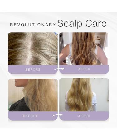 Citrus Cider Whip Hair Plaster | Vitamin C Hair Treatment | Revitalize Damaged Hair with Fruit Butters & Oils - Buy Online on GoSupps.com