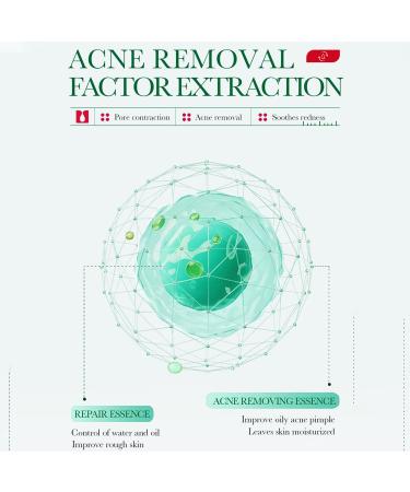 BIOAQUA Salicylic Acid Acne Removal Essence - Shrink Pores Soothing Redness Fade Acne Marks - 35ml / 1.23fl.oz - International Shipping Available - Buy Online on GoSupps.com