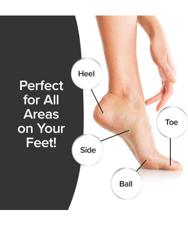 Ped Egg Classic Callus Remover | As Seen On TV | Safely Remove Tough Calluses & Dry Skin | 135 Precision Micro-Blades | Mess-Free | White - Buy Online on GoSupps.com