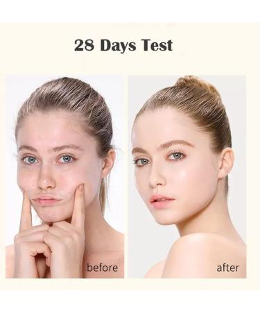 Magic Strips for Face Wrinkles Magic Strips Eye Lifting Strips Face and Forehead Wrinkle Patches Lift Anti Wrinkle Patches (Eyes 5pairs) - Buy Online on GoSupps.com