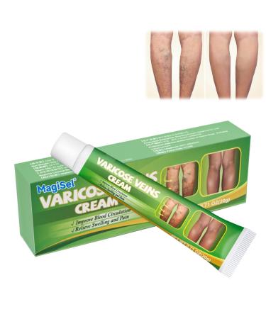 TUITUII Varicose veins spider vein patch spider vein patch veinfree herbal patches antivaricose veins soothing legs veins removal patch 20 g