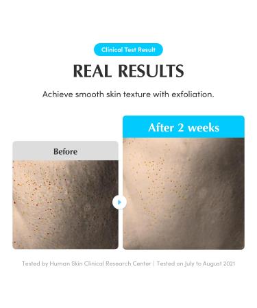 Swimming Pool Toner - Korean Toner for Daily Exfoliating & Deep Hydration with Natural Enzyme Protease & Hyaluronic Acid For Sensitive Skin 10.14 Fl Oz (300ml) - Buy Online on GoSupps.com